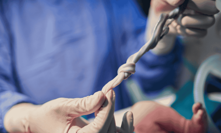 5 Fakta Menarik tentang Umbilical Cord yang Jarang Diketahui Ibu Hamil